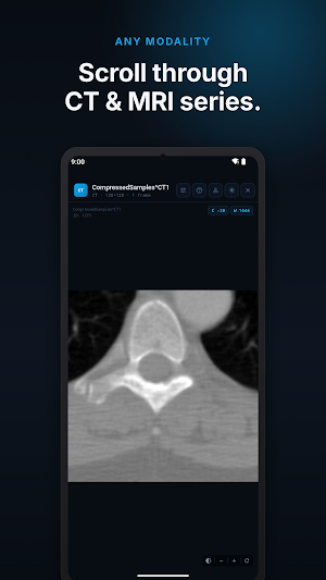 Radix DICOM Viewer: CT & MRI Screenshot 1