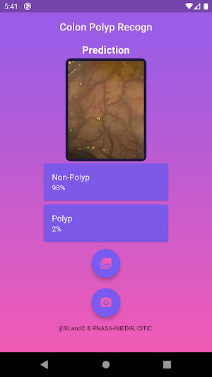 Colon Polyp Recogn Screenshot 3