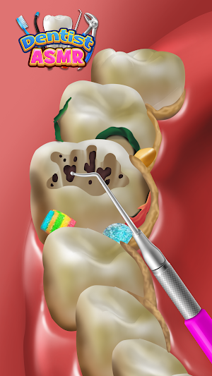 Dentist Office: Root Canal Sim Screenshot 2
