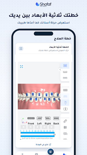 Shafaf Clear Aligners Screenshot 3