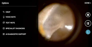 hearScope Screenshot 0