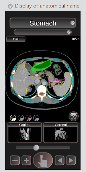 CT Passport Abdomen / sectional anatomy / MRI Screenshot 0