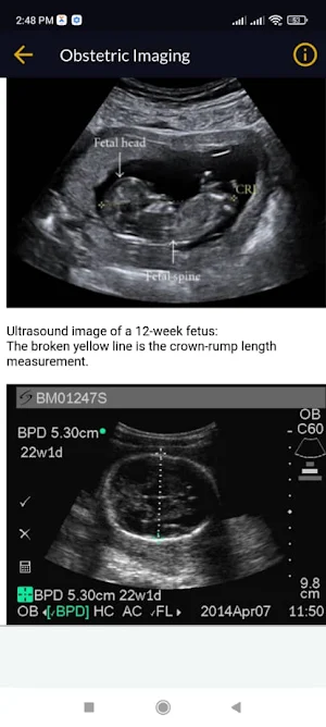 Obstetrics Screenshot 1