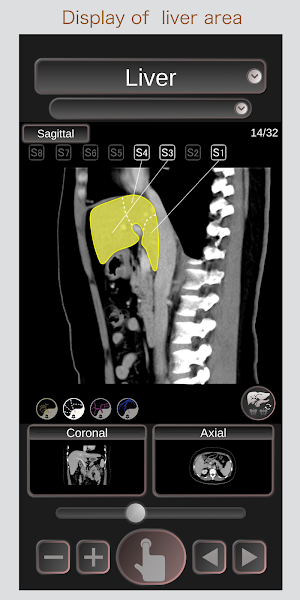 CT Passport Abdomen / sectional anatomy / MRI Screenshot 2