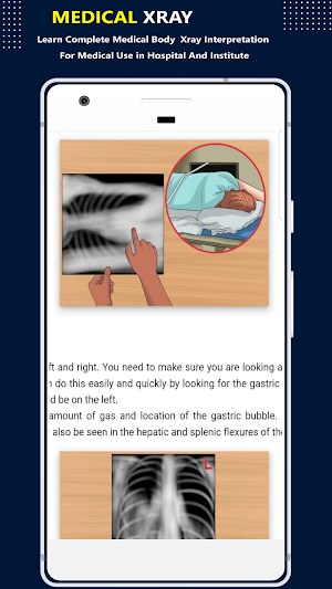 X-Ray Interpretation Guide Screenshot 3