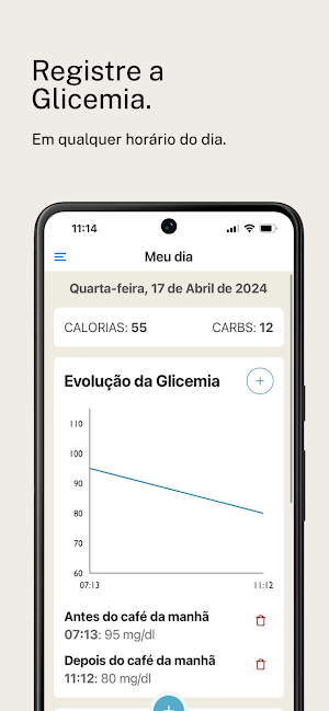 Contagem de Carboidratos - SBD Screenshot 3