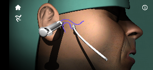 MisTMJ Screenshot 3