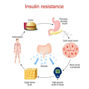 insulin resistance Screenshot 1