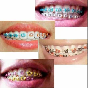 Braces Design Screenshot 0