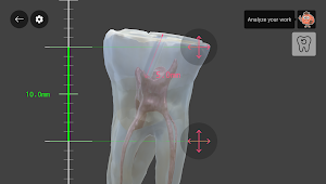Dental Insight Master Screenshot 3