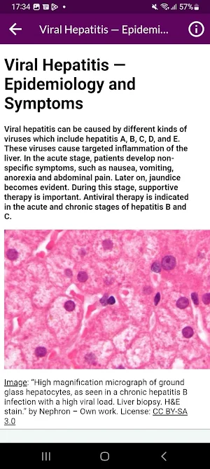 Infectious Disease & Treatment Screenshot 3
