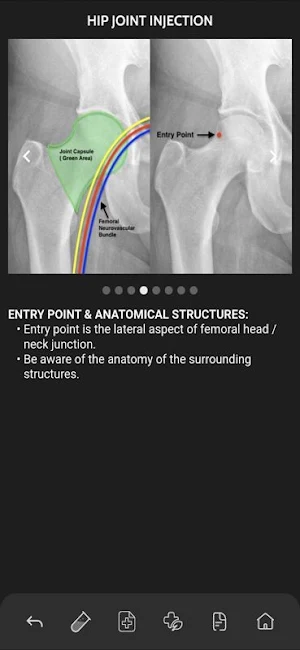 VBS RadGuide: MSK Injections Screenshot 0