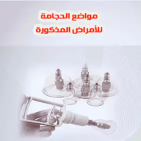 مواضع الحجامة