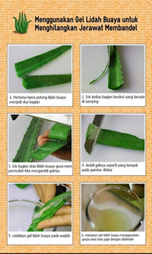 Cara Menghilangkan Komedo Dan  Screenshot 0