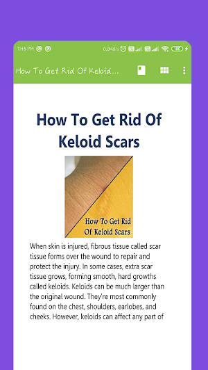 How To Get Rid Of Keloid Scars Screenshot 1