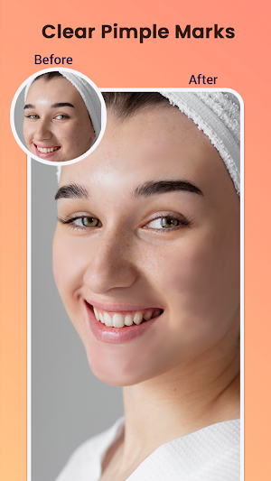 Pimple Remover - Beauty Face Screenshot 1