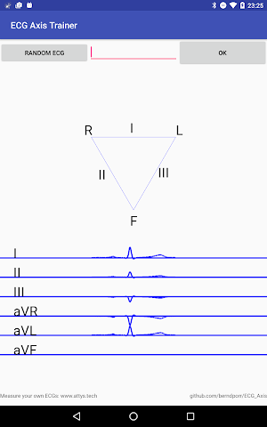 ECG Axis Trainer Screenshot 2