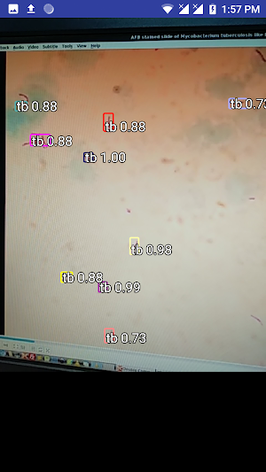 Tuberculosis Screenshot 1