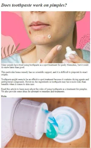 Toothpaste For Pimples Tips Screenshot 3