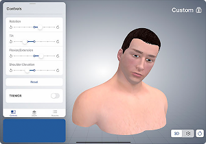 3D Cervical Dystonia Screenshot 0
