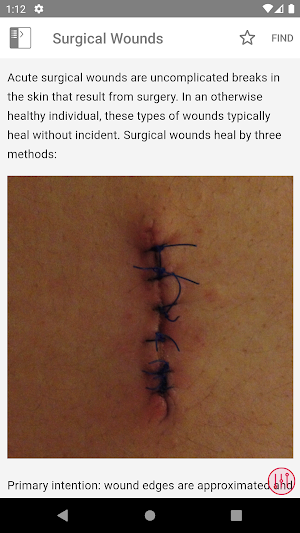 Wound Care Made Incredibly Visual Screenshot 3