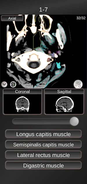 CT PassQuiz Head/Brain / sectional anatomy / MRI Screenshot 2