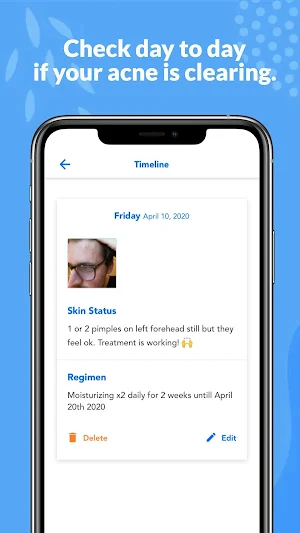 SkinTheory: Skin + Acne Tracker Screenshot 3