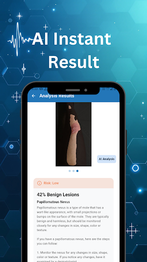 SkinSense AI Dermatologist Screenshot 3