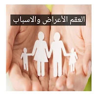 العقم الأعراض والاسباب