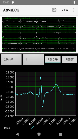 AttysECG Screenshot 2
