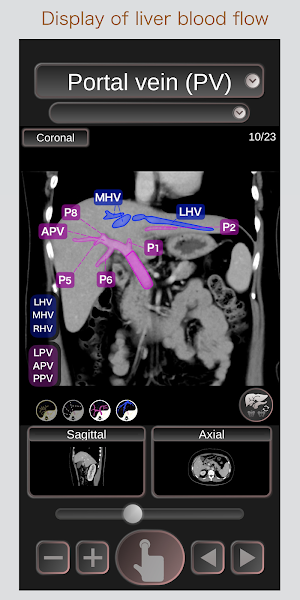 CT Passport Abdomen / sectional anatomy / MRI Screenshot 1