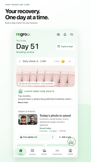 Regrow: Hair Transplant Care Screenshot 0