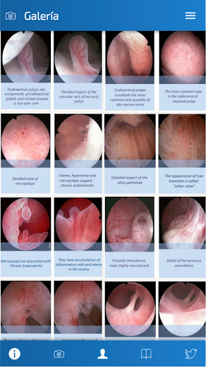 Hysteroscopy News Screenshot 1