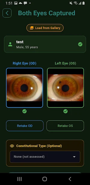 Iridology Analysis Toolkit Pro Screenshot 3