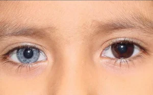 Eye Colour Changes Screenshot 3