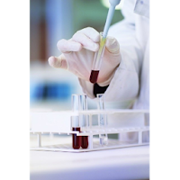Hepatitis B Serology