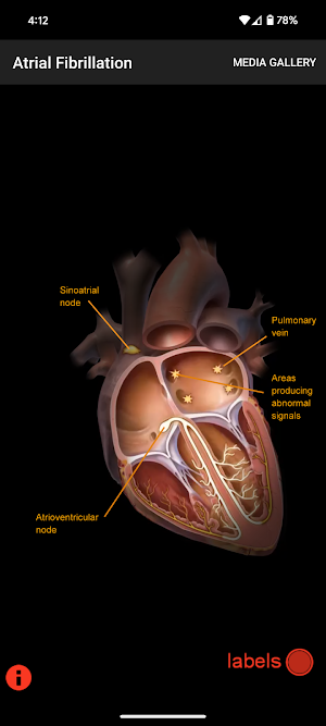 Hx Heart Screenshot 1