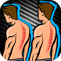 Posture Correction Exercises