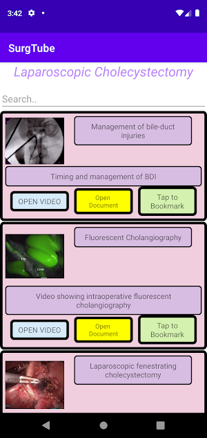 SurgTube Screenshot 1