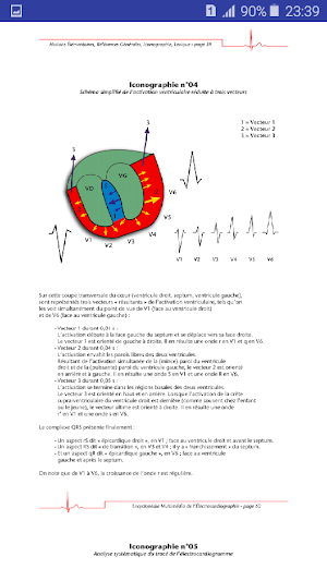 Interpreter un ECG Screenshot 1