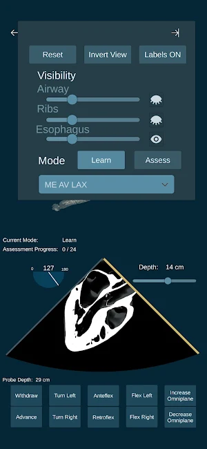 UMN TEE Screenshot 1
