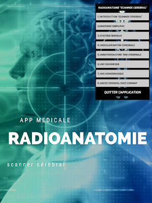radio-anatomie"scanner cérébral" Screenshot 1