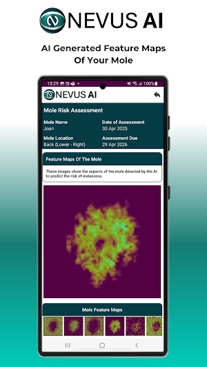 Nevus AI Screenshot 3