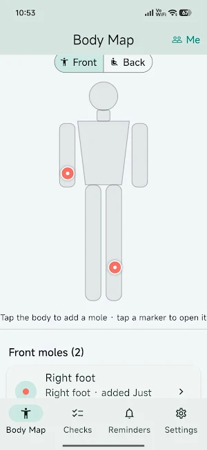 Mole & Skin Check Tracker Screenshot 0