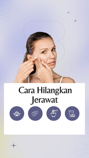 Cara Cepat Hilangkan Jerawat Screenshot 3
