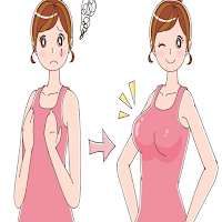 breast augmentation