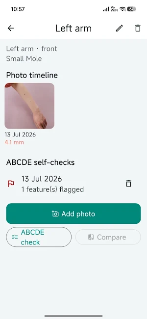 Mole & Skin Check Tracker Screenshot 3