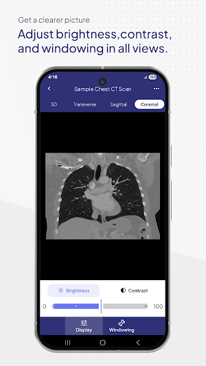 3DICOM Mobile Screenshot 3
