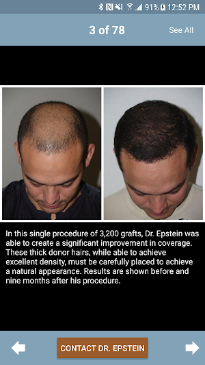 Plastic Surgery & Hair Restore Screenshot 1