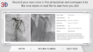 AngioAID 3D Screenshot 2